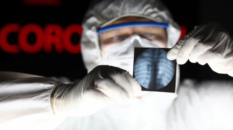 W wydaniu specjalnym programu "36,6" gościł prof. dr hab. Adam Antczak, pulmonolog, który odpowiedział na pytania związane z pandemią koronaw