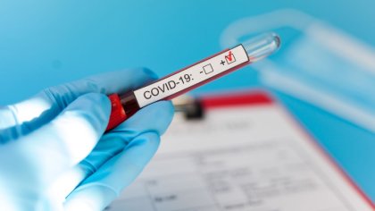 Ostrów Mazowiecka - W kierunku koronawirusa przebadano dotąd 85 tys. 467 próbek,