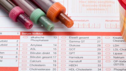 Ostrów Mazowiecka - Hematologia to jedna z dyscyplin medycznych, o której nie sł