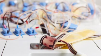 Ostrów Mazowiecka - Przepięcie elektryczne nie jest rzadkim zjawiskiem w gospoda