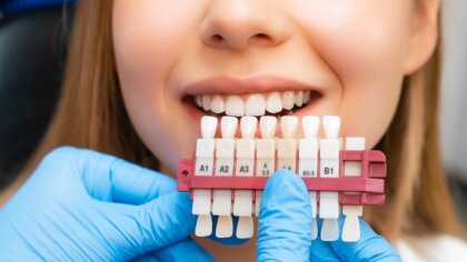 Ostrów Mazowiecka - Białe i lśniące zęby to marzenie wielu osób, które pragną ol