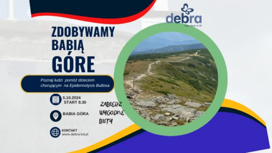 Fot. Stowarzyszenie Debra Polska Kruchy Dotyk -Epidermolysis Bullosa - EB