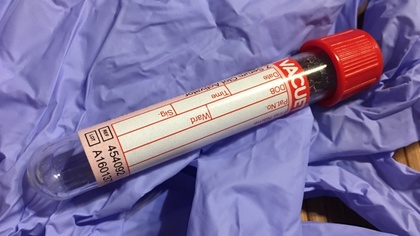 Ostrów Mazowiecka - W poniedziałek 11 września od godz. 9.00 będzie można oddać 